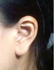 青島哪家整形醫(yī)院效果比較好？排名前三的華顏美堪稱(chēng)翹楚！