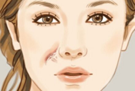 長(zhǎng)沙亞韓醫(yī)院：專家親診！割雙眼皮價(jià)格解析和醫(yī)院簡(jiǎn)介