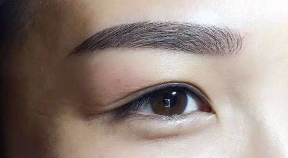 蘭大一院皮膚科哪位醫(yī)師實力出眾？專家解析與患者分享激光祛痘案例，附詳細價格表！