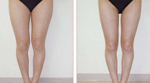 深圳市有哪些經(jīng)驗豐富的脂肪填充醫(yī)生？Top五名單揭曉！