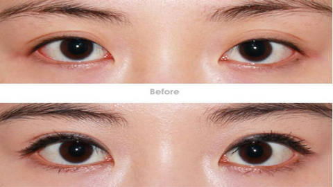 河南省中醫(yī)院整形科是吳盤紅、馬垟垟實力展示嗎？整形效果如何？