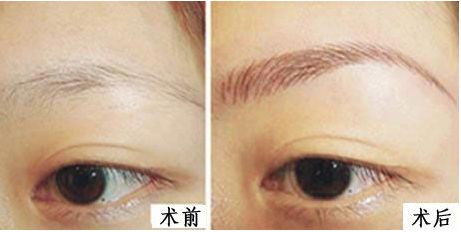 濰坊整形醫(yī)院排行榜揭曉！綜合評比推薦前五強熱門醫(yī)院，超值推薦！