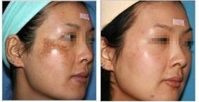 西京醫(yī)院郭樹忠教授：醫(yī)術(shù)高超，贏得廣泛口碑