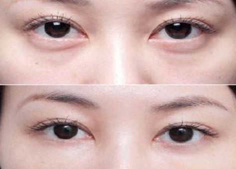 學(xué)生黨必備！性價(jià)比超高的祛黑眼圈眼霜推薦