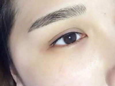 深圳吸脂美萊秀真的值得嘗試嗎？效果真的令人滿意嗎？