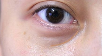 沈陽(yáng)市精修胸部重塑診所排行榜，為您推薦備受好評(píng)的整形醫(yī)療機(jī)構(gòu)