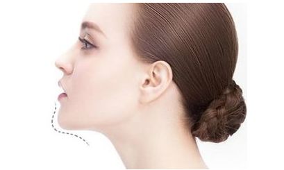 上海九院張?zhí)锰疳t(yī)生2023手術案例分享，讓你了解周雙白醫(yī)生的臨床經(jīng)驗