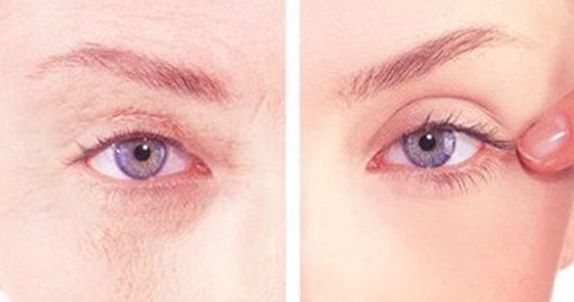 沈陽醫(yī)大二院美容整形科權威專家盛裝亮相，2023價格表曝光，丨真絕佳效果去眼袋案例讓人羨慕