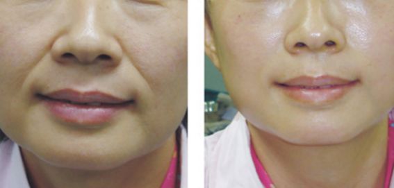 哪位醫(yī)生是擅長進(jìn)行顱頜面手術(shù)的專家？名單更新與價格參考