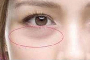 韓國(guó)優(yōu)質(zhì)整形醫(yī)院推薦，專(zhuān)業(yè)假體隆鼻術(shù)效果好