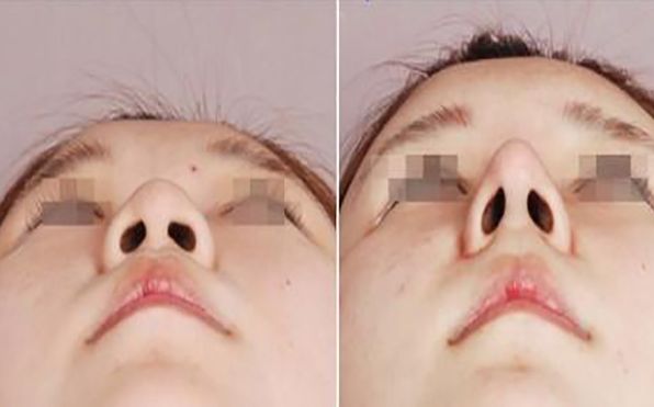 北醫(yī)三院眼科攻略：掛號預(yù)約、專家介紹、2024費用一覽