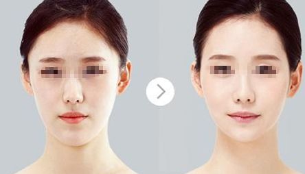 鄭州哪家醫(yī)院比較好做唇部整形？