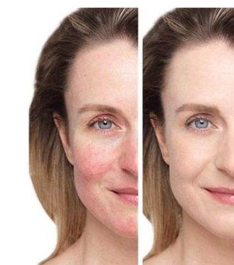 【長春市】優(yōu)質(zhì)整容醫(yī)院推薦！匯總前五家大熱門名單揭曉