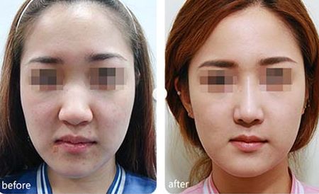 蘇州瘦身效果排名靠前的醫(yī)院推薦