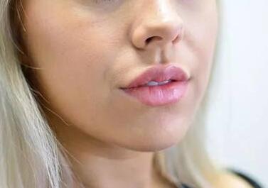 福建省第二人民醫(yī)院整形外科的技術水平如何？該醫(yī)院整形外科好不好？