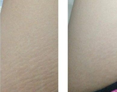 成都哪家醫(yī)院2023熱門雙眼皮全切推薦，醫(yī)院名單及簡介全解析！