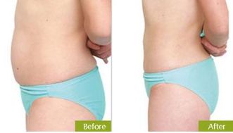 上海鼻子整形十位知名權(quán)威專家推薦