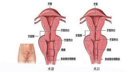 北京最佳乳房再造醫(yī)院排行榜，八強(qiáng)環(huán)境多元，知名醫(yī)生鼎力支持