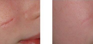 昆明知名醫(yī)生解讀三角眼與下垂眼手術(shù) 手術(shù)專業(yè)有哪些？