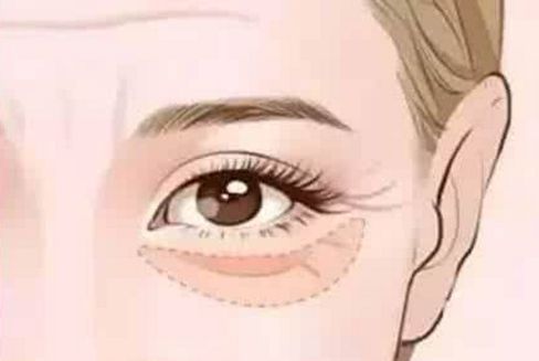 成都市有哪些值得信賴的整容醫(yī)院？友誼醫(yī)院、中醫(yī)大銀海、東籬醫(yī)院等在榜