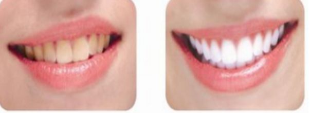 南昌哪家整形醫(yī)院的除皺手術比較好？前十實力醫(yī)院推薦!