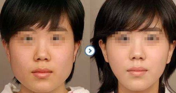 邯鄲梵星醫(yī)療美容：技術(shù)實力聚焦，項目擅長解讀，價格參考公開