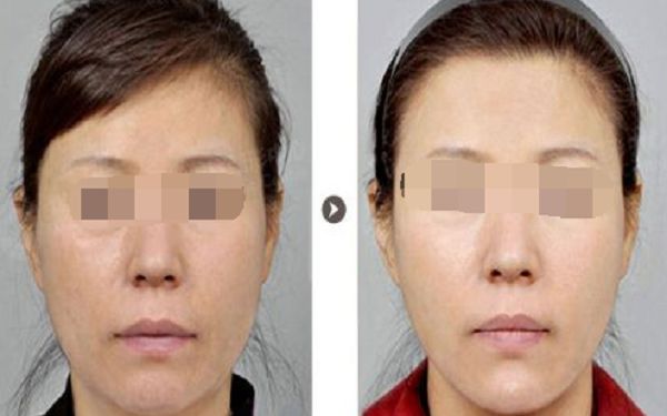 祁峰醫(yī)生面診全攻略：預(yù)約到面診流程詳細分享