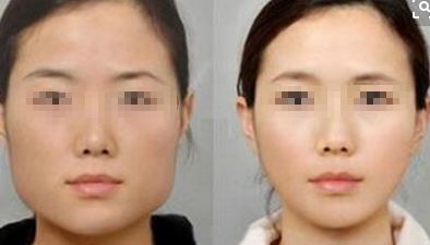 2024年鄭州市熱門(mén)整形醫(yī)院推薦，在排名前10中有哪些？