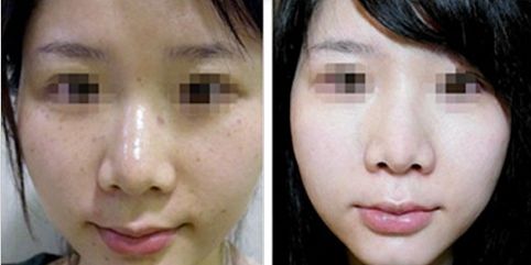 合肥哪幾家三甲整形醫(yī)院受歡迎？