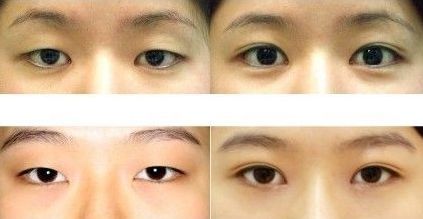 上海眼王醫(yī)生排行榜前五名大咖介紹，助您尋找頂級專家