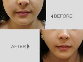 上海九院鼻部整形權(quán)威醫(yī)生曝光，李青峰、章一新上榜！