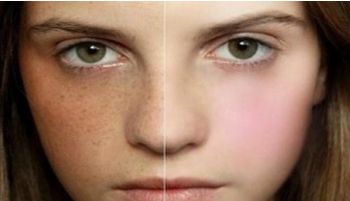 上海腹壁整形術(shù)受歡迎的醫(yī)院排行榜，九院、華美和伊萊美等備受推薦