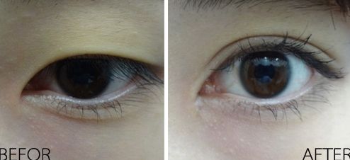 長沙的吉大二院整形科效果如何？項(xiàng)目費(fèi)用一覽表2023