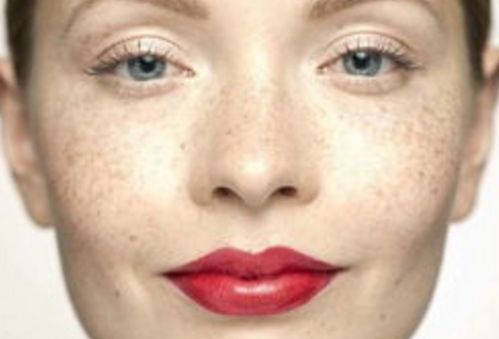 孫澤芳醫(yī)生的眼袋手術(shù)效果如何？醫(yī)生背景資料與實際手術(shù)對比圖分享