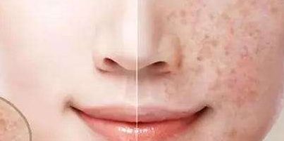 2023年大連顴骨顴弓修復(fù)醫(yī)生推薦，醫(yī)師排行公開！附最新收費(fèi)一覽！