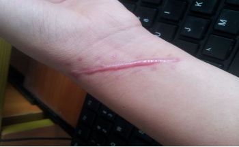 哈爾濱市第五醫(yī)院整容科負(fù)責(zé)人是誰？名醫(yī)陣容+服務(wù)價(jià)目公示給您參考