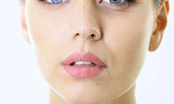 2023醫(yī)生推薦的鼻綜合重塑，讓邱文苑的鼻子煥然一新！