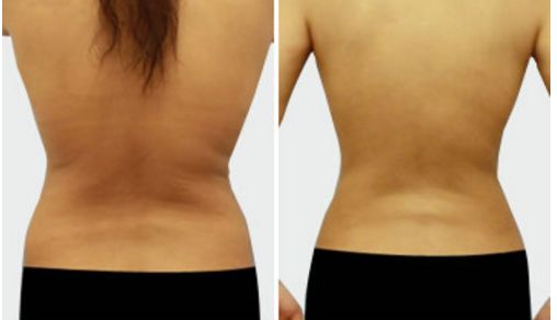 名醫(yī)孟祥宏師傅：創(chuàng)造完美鼻型的心靈藝術(shù)！