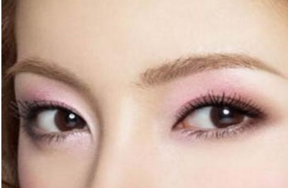 北京協(xié)和醫(yī)院白明醫(yī)生的雙眼皮手術(shù)效果如何？真實(shí)案例展示給你看