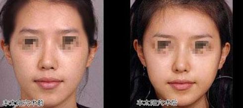 東莞哪家植發(fā)醫(yī)院口碑更好？這些知名醫(yī)院值得關(guān)注