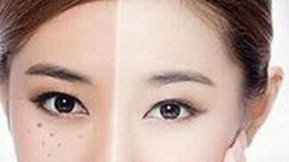 獨家揭秘！了解重慶楊武林醫(yī)生的墊下巴整形全過程