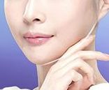 上海星時(shí)代張悅迪醫(yī)生精準(zhǔn)雙眼皮手術(shù)的2023成功案例分享