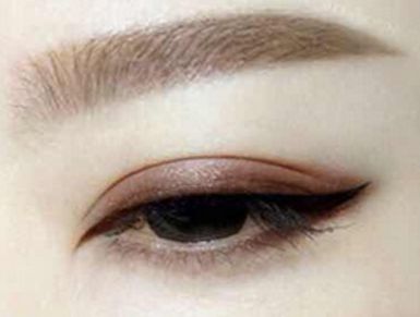 盧尚兵醫(yī)生成功挖掘雙眼皮修復秘密，踏實解決眼皮腫脹問題