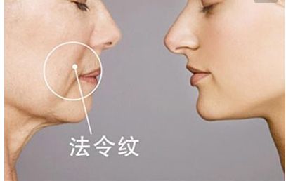 長(zhǎng)沙田毅雙眼皮手術(shù)新穎獨(dú)特，引領(lǐng)2023最新潮流