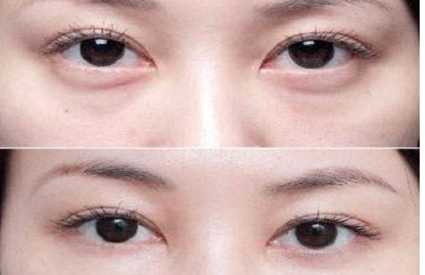 沈陽(yáng)哪個(gè)醫(yī)院的整形專家口碑好，醫(yī)術(shù)高超的醫(yī)生推薦