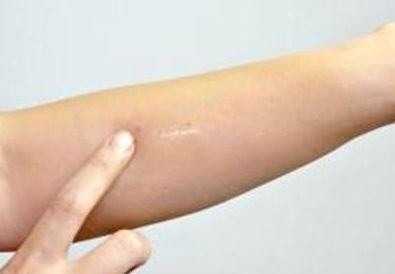 上海新星整形美容醫(yī)院——醫(yī)生團隊、價格透明一目了然!