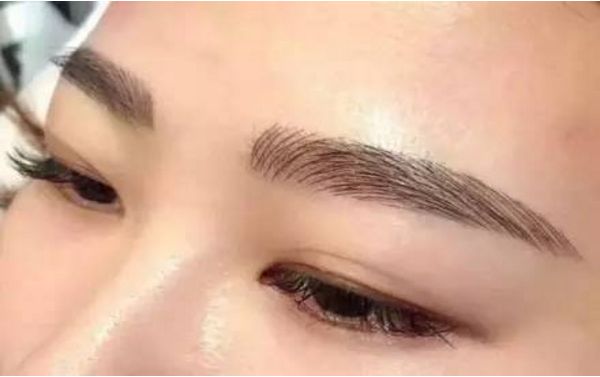 何晉龍磨骨成功，面容煥然一新！讓人難以置信的手術(shù)效果！