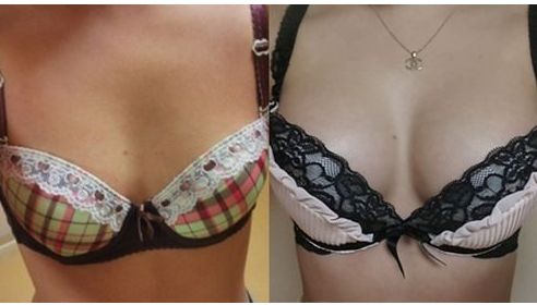 湖南地區(qū)雙眼皮手術(shù)醫(yī)生排行榜單盛裝亮相！提供熱門名醫(yī)推薦供您選擇！