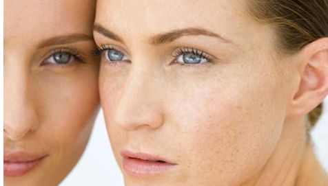 眼部修復案例比較：2023年眼睛整形術于曉波和劉輔容，哪個更理想的選擇