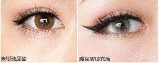 昆明市尋找雙眼皮醫(yī)生，這六位專家口碑爆棚！技術(shù)高超讓你滿意！